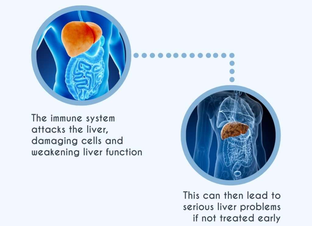 Autoimmune Hepatitis Moonee Valley Specialist Centre